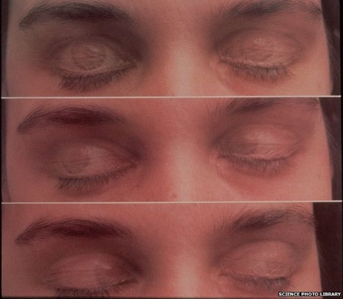 REM 수면 상태에서 움직이는 눈동자 출처: BBC