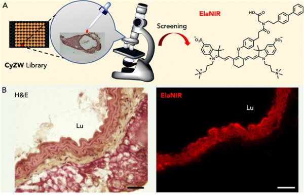 ElaNIR 구조와 ElaNIR로 염색된 엘라스틴. 출처: IBS