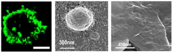 왼쪽부터 차례로 광수용체를 생산하는 세포, 나노 크기 소포 형태로 생산한 광수용체, 그래핀 표면에 광수용체를 적층한 소재 출처: KIST