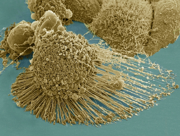 세포자살 중인 헬라 세포 출처: NIH