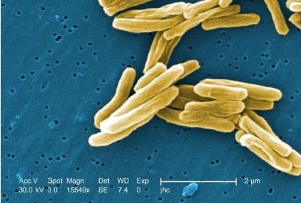 비냄새를 만드는 미생물 ‘actinobacteria’출처: Encyclopedia of Life