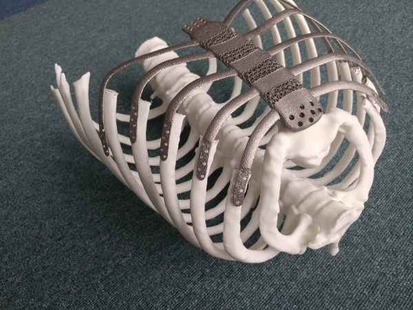 3D프린팅 인공 흉곽이 인체 모형에 부착된 모습. 출처: 한국생산기술연구원