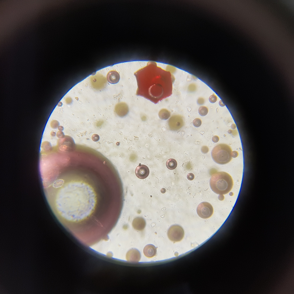 현미경으로 관찰한 슬라임