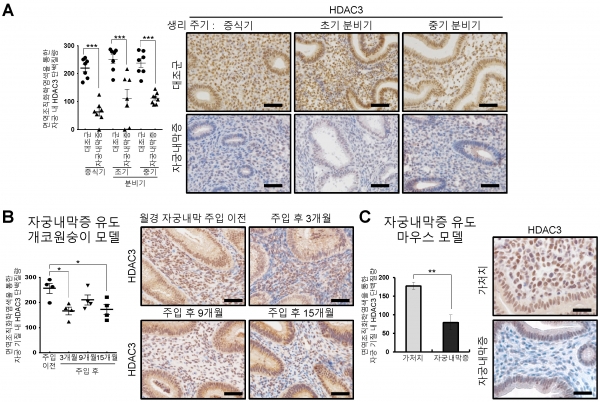 자궁내막증 환자의 자궁 내막에서 HDAC3 단백질량 감소. 출처: 한국연구재단