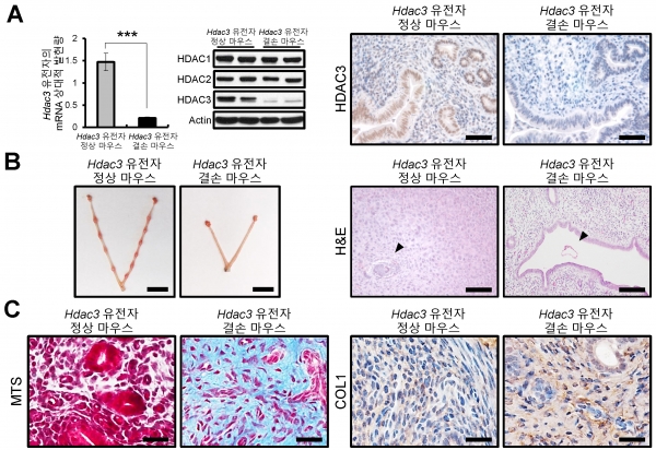 Hdac3 유전자가 결손되면 자궁의 배아 착상능 상실, 자궁조직 섬유화, 콜라겐 증가. 출처: 한국연구재단
