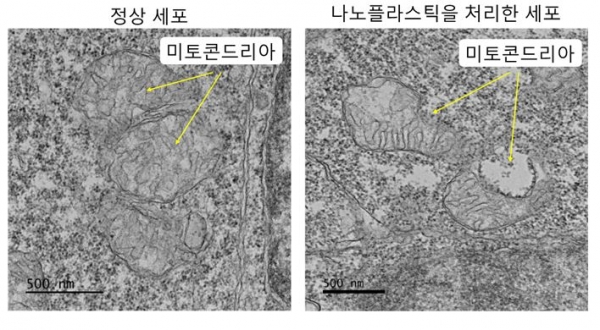 (초)미세플라스틱이 미토콘드리아에 미치는 영향을 비교한 전자현미경 사진. 출처: 한국생명공학연구원