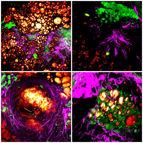비선형광학현미경으로 이미징한 혈관의 모습. 출처: 한국표준과학연구원