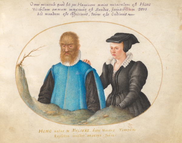 16세기에 기록된 다모증 환자. 출처: Wikimedia Commons