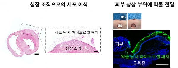 하이드로젤 테이프를 활용한 줄기세포 및 약물 전달. 출처: 한국연구재단
