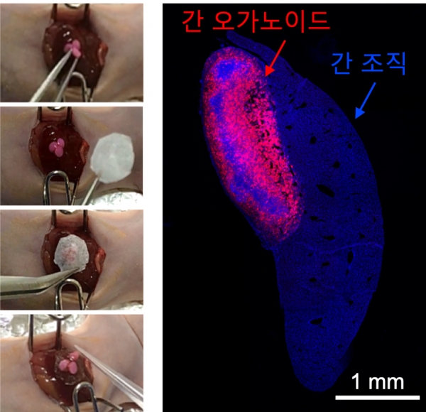 하이드로젤 테이프를 이용한 간편하고 효과적인 오가노이드 이식. 출처: 한국연구재단