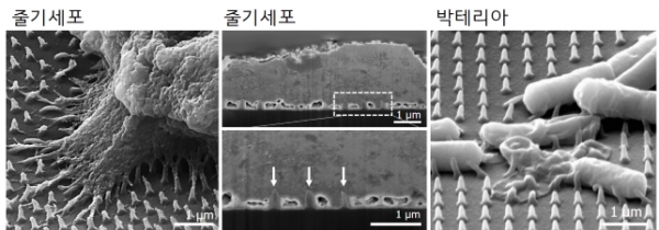 나노바늘구조 자극을 받은 줄기세포와 박테리아의 전자현미경 이미지. 출처: 한국연구재단