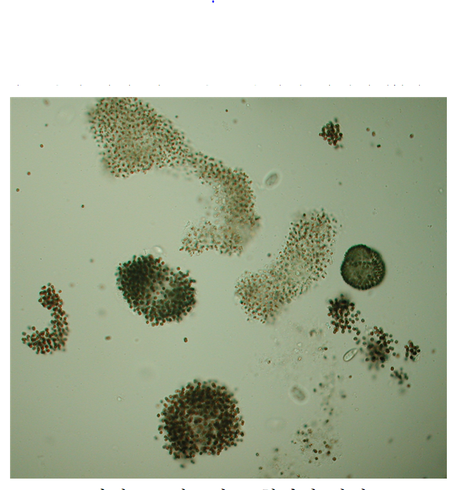 마이크로시스티스 현미경 사진. 출처: 한국생명공학연구원