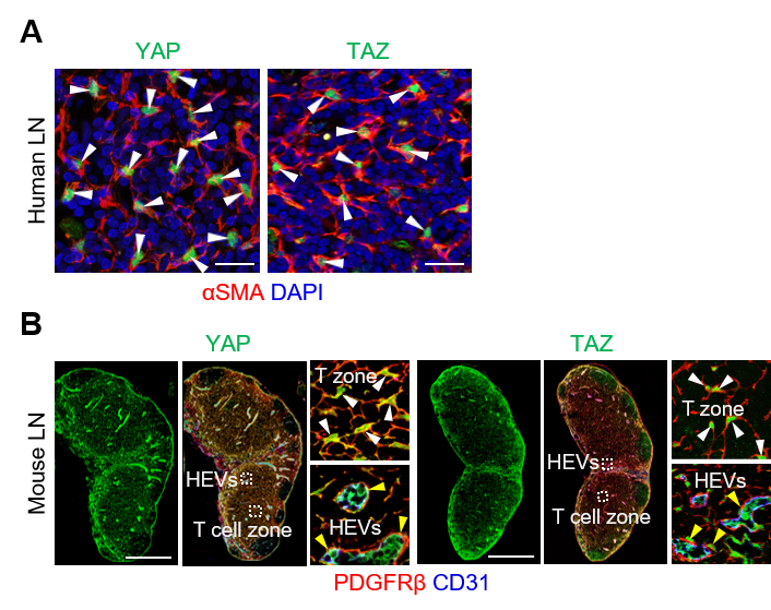 림프절 내 섬유아 세망세포의 분화 정도와 히포 신호전달경로 연관성. 출처: IBS