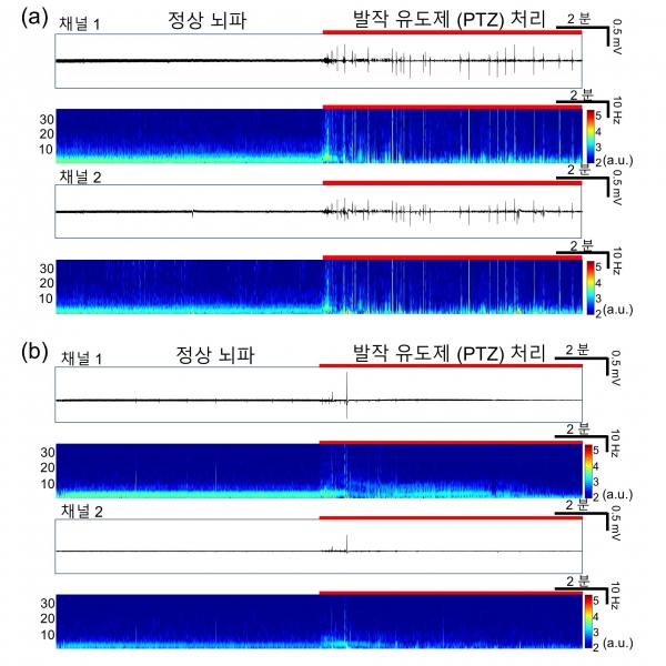 측정된 뇌파 신호의 예시. 출처: DGIST