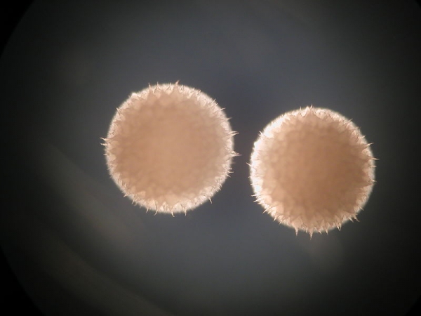 스트렙토미세스 히그로스코피쿠스(Streptomyces hygroscopicus). 출처: Wikimedia Commons