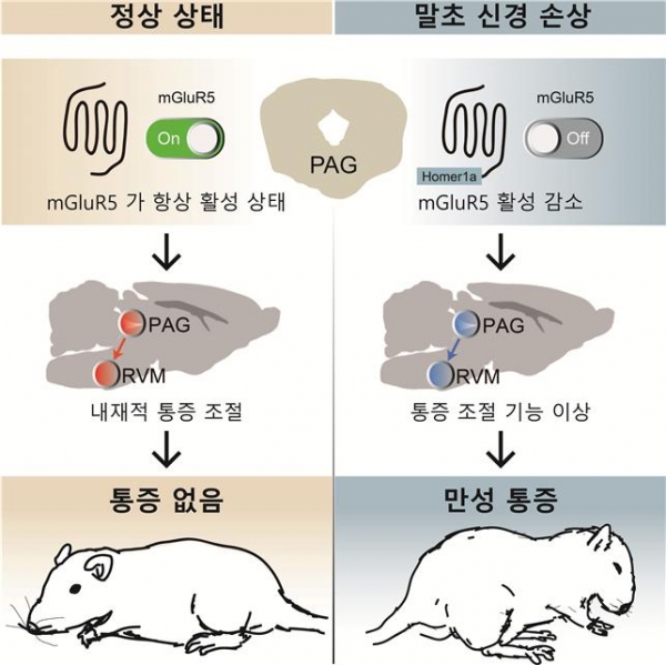 뇌의 통증조절 영역 PAG 의 활성에 따른 통증 양상 변화. 출처: 한국연구재단