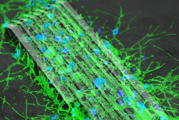 신경세포 전달 마이크로로봇 이미지. 마이크로로봇에 올려진 신경세포가 마이크로 패턴을 따라 배양되는 모습을 형광이미징으로 나타내고 있다. 출처: DGIST