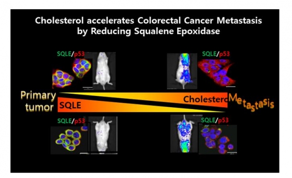 콜레스테롤에 의한  대장암 전이 가속화 모식도. 출처: 한국생명공학연구원