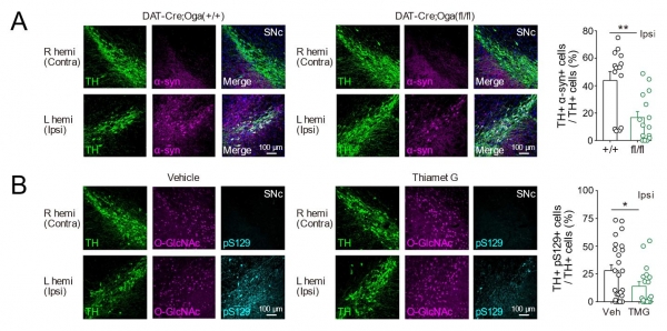 중뇌(midbrain) 흑색질(SNc) 도파민 신경세포에서 오글루넥당화(O-GlcNAcylation)를 증가시켰을 때의 변화. 출처: UNIST