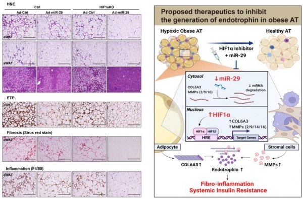 miRNA-29의 효과와 HIF1a 억제제·miRNA-29 병용 치료 전략 모식도. 출처 : UNIST