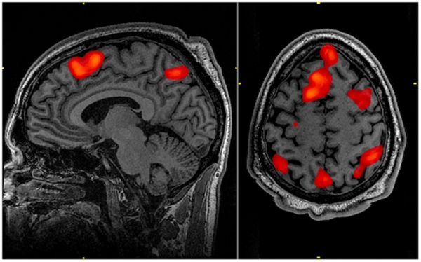 fMRI로 스캔한 뇌. 출처: Wikimedia Commons