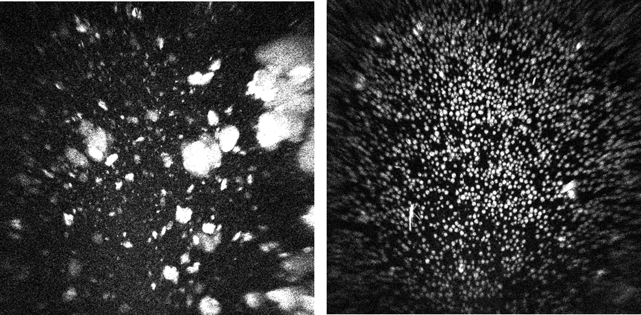 지구에서의 샘플 UV 이미징 (왼쪽)과 우주환경 (오른쪽). 미세중력인 우주에서 결정화가 더 잘되고 있다. MEDIA CREDIT: Image courtesy of Merck